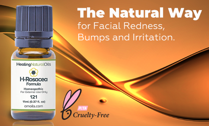 H-Rosacea Formula Review